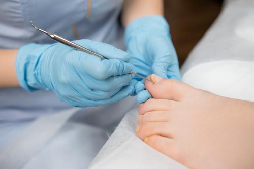 Ingrown Toenail Workshop